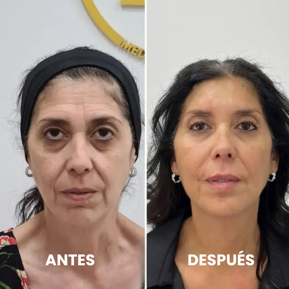 <p>Energía, bienestar y vitalidad comprobados… +25.000 <strong>Testimonios Verificados lo Respaldan</strong></p>