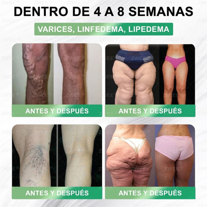 Tienda Oficial | ZWEEN® GLP-1 Oral 💊 12-en-1 Formula Avanzada 🇲🇽 (Solo 1 al día, cambios visibles en 7 días) 👨‍⚕️ Control de apetito, metabolismo, grasa corporal, apnea del sueño, problemas articulares y más 💝