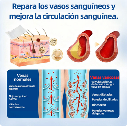 Tienda Oficial | 𝐻𝑒𝑎𝑙𝑟𝑖𝑧𝑒® Piernas Ligeras 12-en-1 🩹 Advanced Nano Microneedle Patch 🇲🇽 (Una vez al día · resultados en 7 días) 👨‍⚕️ Para várices, Reduce arañitas, mejora circulación, alivia piernas cansadas  y esa pesadez que no te deja estar cómoda 💝